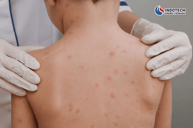 Dampak Air Bau Besi bagi Kesehatan