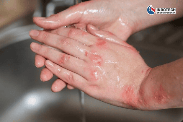 Dampak Air Bau Karat