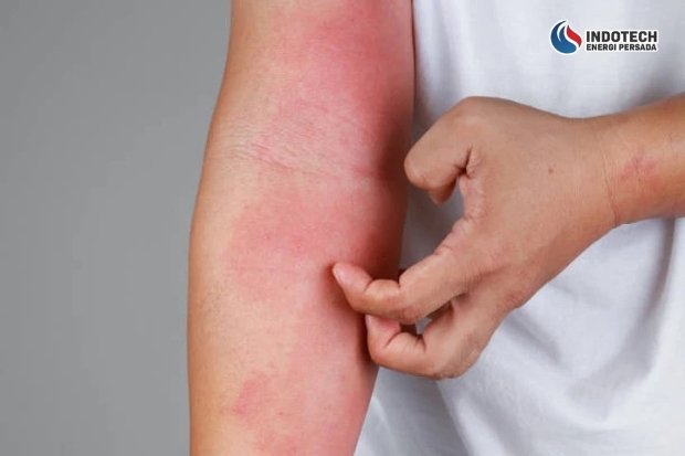 Dampak air sumur bor bau