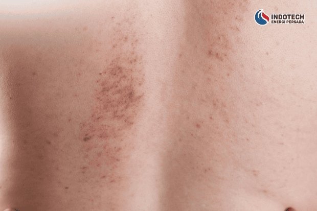 Dampak Air Sumur Berwarna Kuning