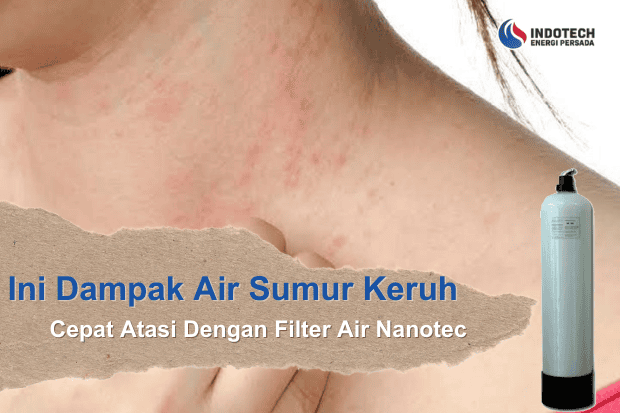Dampak Air Sumur Keruh