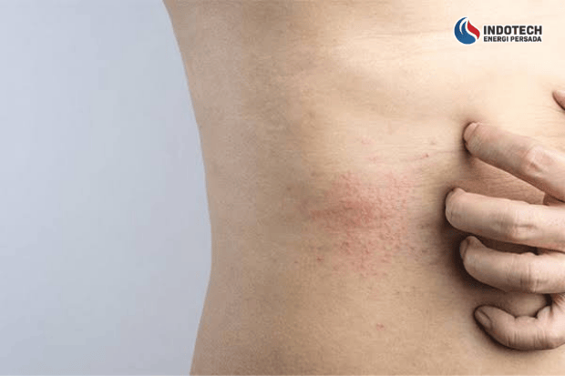 Dampak Jika Air Sumur Kotor dan Bau Tidak Ditangani