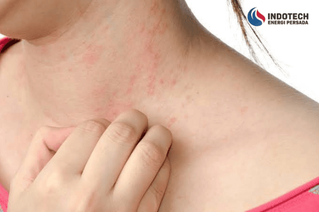 Dampak Menggunakan Air Sumur yang Bau dan Berbusa