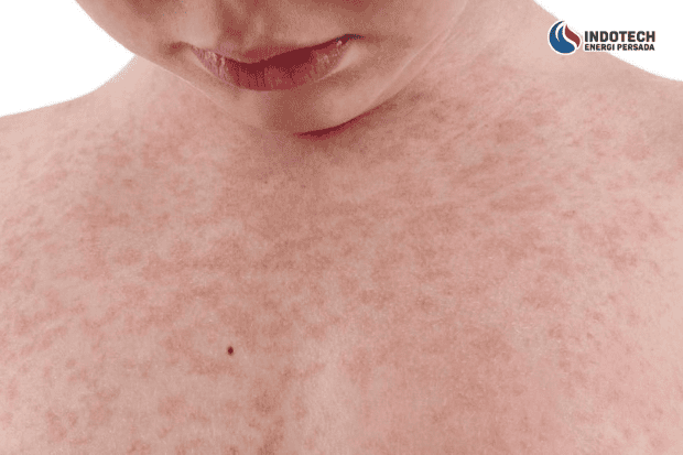 Risiko Menggunakan Air Sumur Berminyak