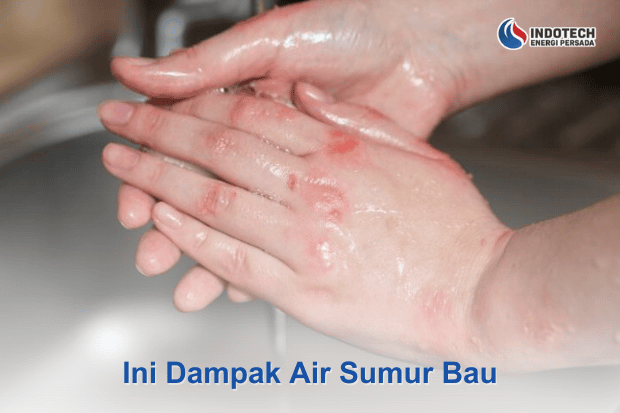 Dampak Air Sumur Bau