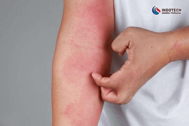 Dampak Air Sumur Kuning dan Bau Jika Tidak Ditangani