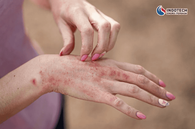 Dampak Air Sumur Kuning dan Berminyak