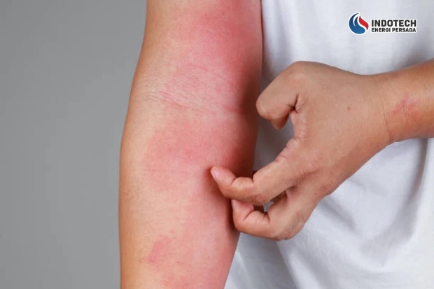 Dampak Air Bau dan Berbusa bagi Kehidupan Sehari-hari